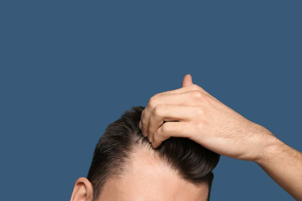 caduta capelli adolescenza