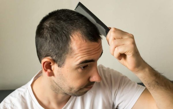 Genetica e colore dei capelli: quali sono i geni che lo determinano?