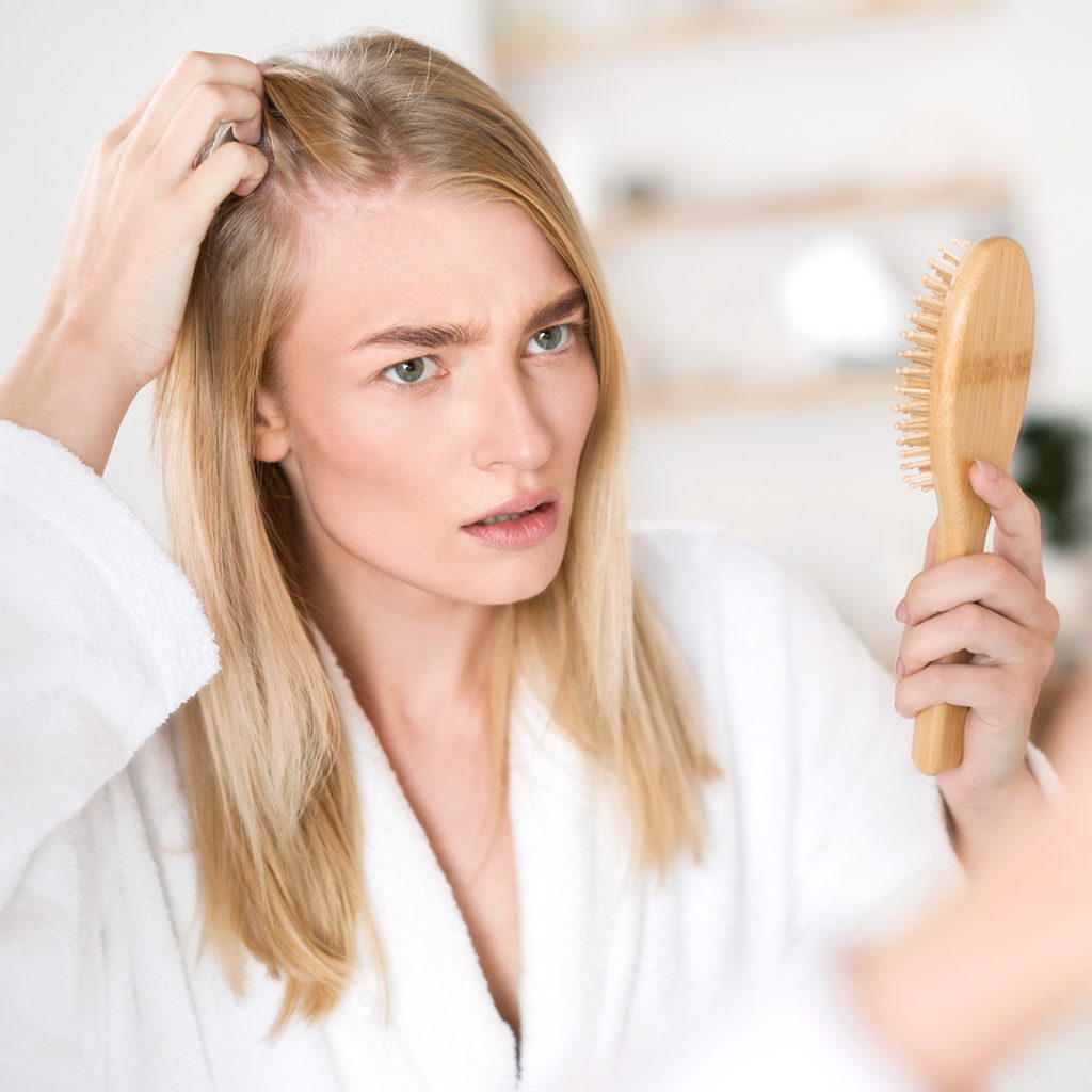 Alopecia androgenetica donna