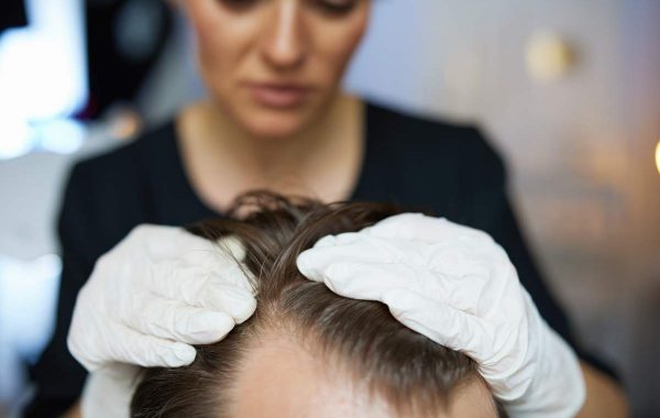 Densità dei capelli