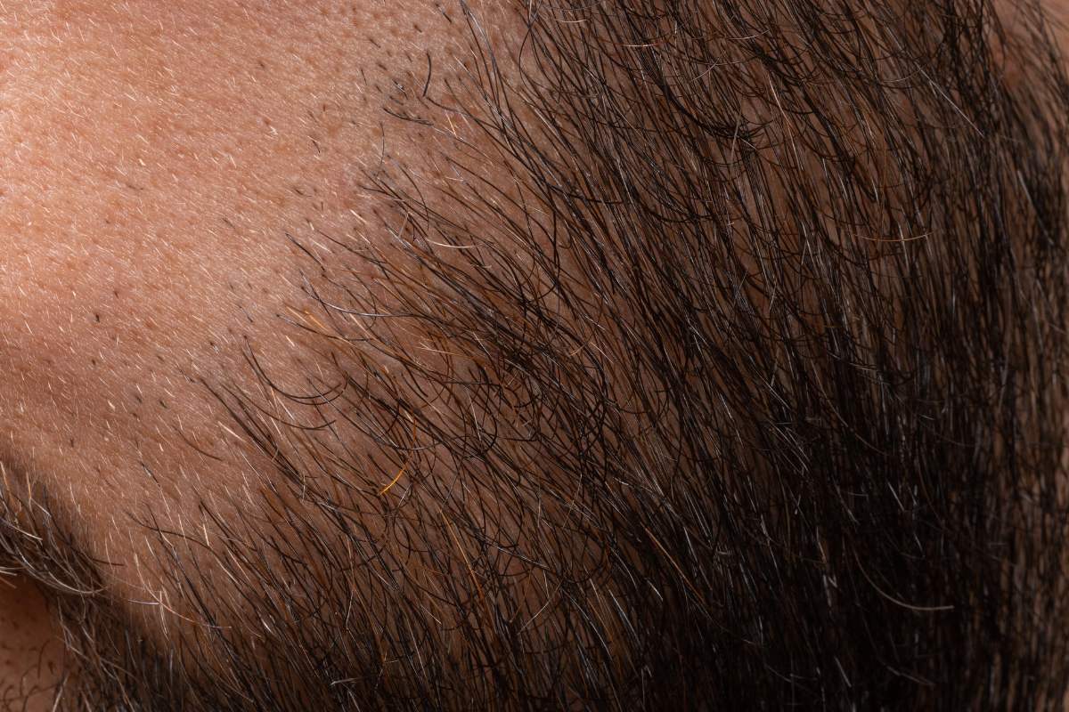 Cosa fare se si hanno capelli radi