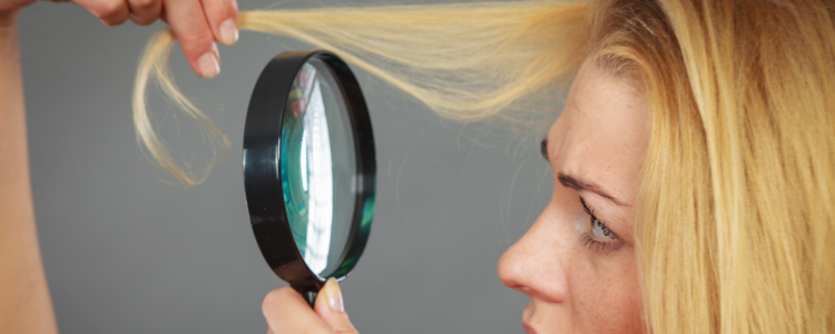Hair Detective: indagini sul cuoio capelluto, cause e rimedi